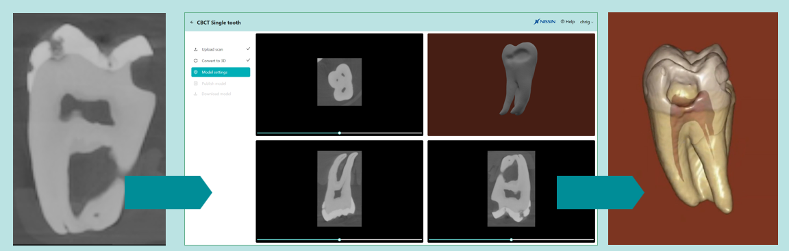 TrueTeethLab Model Settings